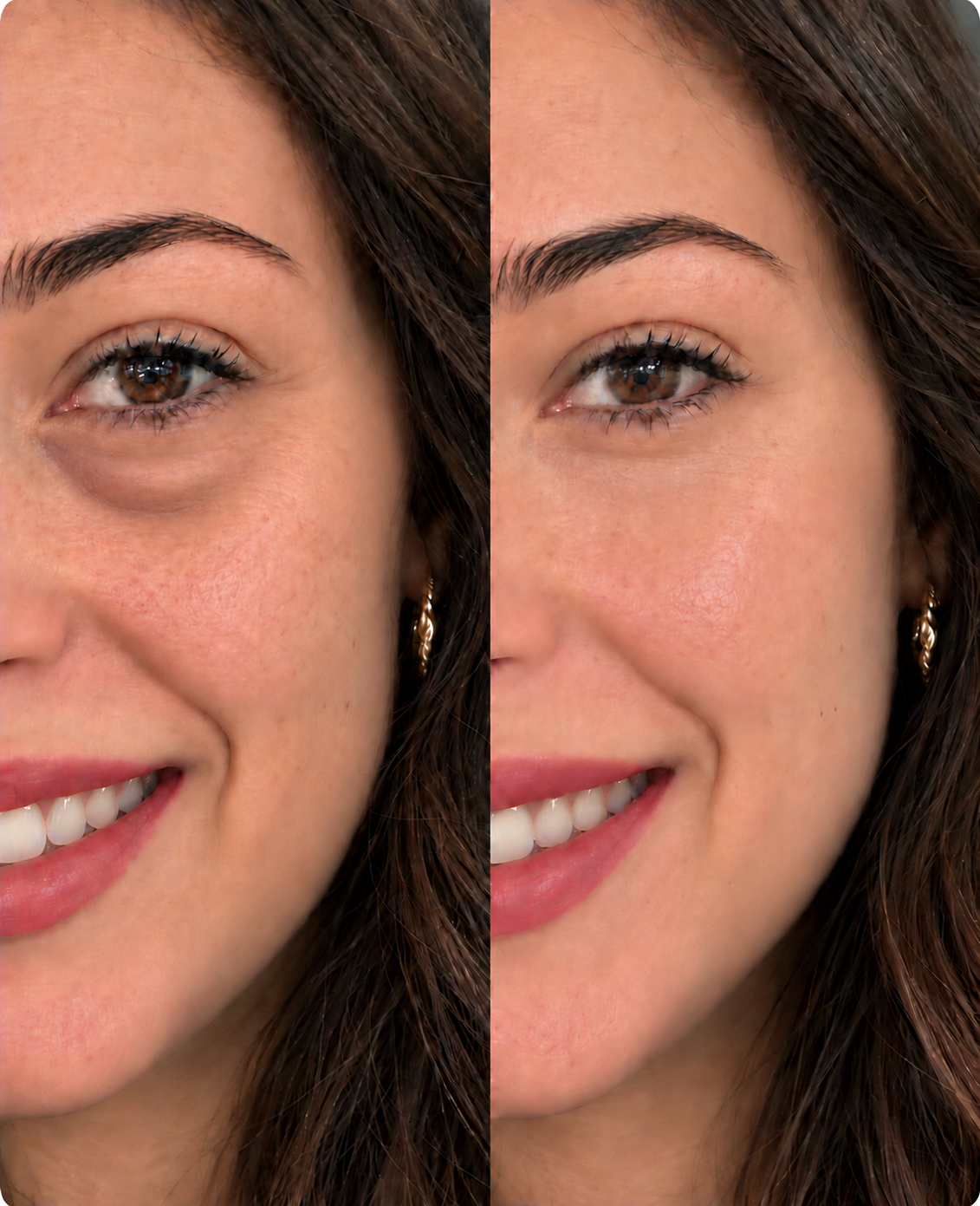 Ce que l'industrie cosmétique ne vous dit pas sur le contour des yeux : 7 raisons pour lesquelles ce soin lissant a déjà été acheté plus de 3 986 fois.
